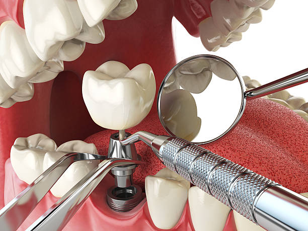 Best Emergency Treatment for Oral Infections in Asbury Park, NJ